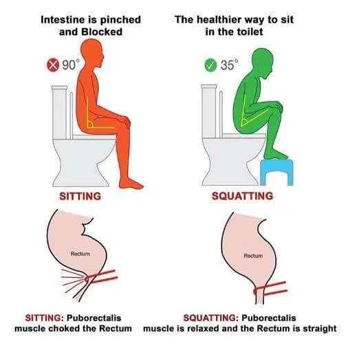 The correct toilet posture to reduce constipation